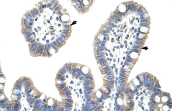 NFKBIB Rabbit Polyclonal Antibody