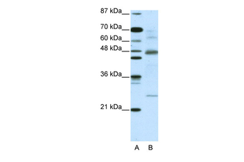 NFKBIB Rabbit Polyclonal Antibody