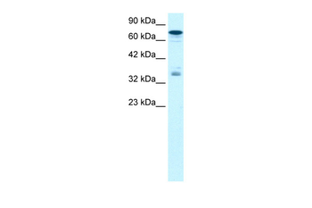 NFKBIB Rabbit Polyclonal Antibody