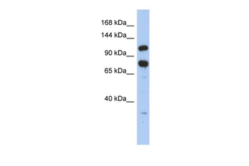 ZFR Rabbit Polyclonal Antibody