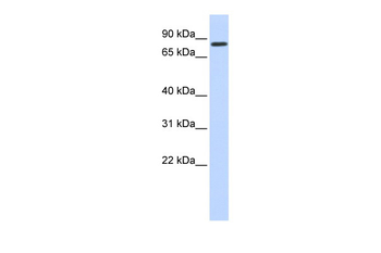 AMOT Rabbit Polyclonal Antibody