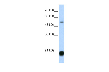CBX3 Rabbit Polyclonal Antibody