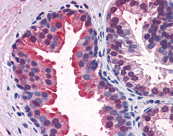 KEAP1 Rabbit Polyclonal Antibody