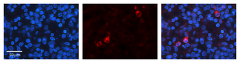 KEAP1 Rabbit Polyclonal Antibody