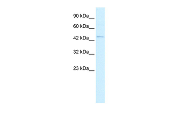 RNF36 Rabbit Polyclonal Antibody