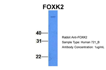 FOXK2 Rabbit Polyclonal Antibody