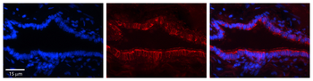 FOXK2 Rabbit Polyclonal Antibody