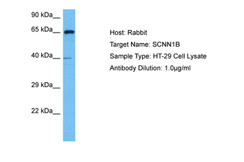 SCNN1B Rabbit Polyclonal Antibody