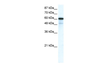 GABRA1 Rabbit Polyclonal Antibody
