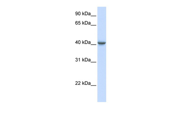 GABRA1 Rabbit Polyclonal Antibody