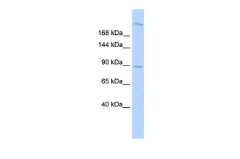 SHROOM2 Rabbit Polyclonal Antibody