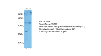 VDAC1 Rabbit Polyclonal Antibody