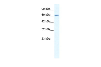 CUL5 Rabbit Polyclonal Antibody