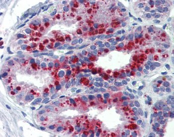 KCNK9 Rabbit Polyclonal Antibody