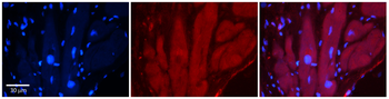TRPV4 Rabbit Polyclonal Antibody