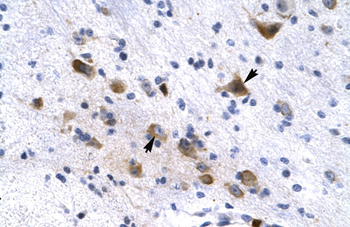 KCNH6 Rabbit Polyclonal Antibody