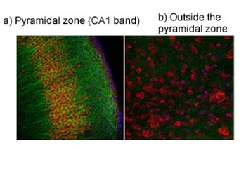 TRPV4 Rabbit Polyclonal Antibody