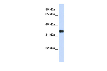 KCTD7 Rabbit Polyclonal Antibody