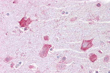 KCNQ2 Rabbit Polyclonal Antibody