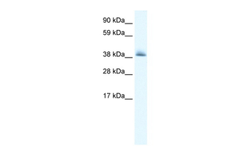 KCTD13 Rabbit Polyclonal Antibody