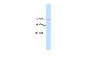 NUDT9 Rabbit Polyclonal Antibody