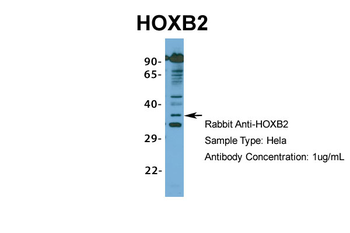 HOXB2 Rabbit Polyclonal Antibody