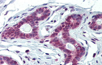 FUBP1 Rabbit Polyclonal Antibody
