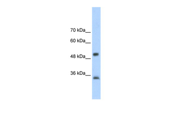 AIP Rabbit Polyclonal Antibody