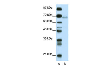 ZBTB22 Rabbit Polyclonal Antibody