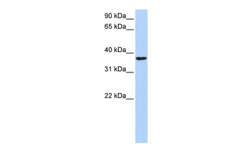 HMG20B Rabbit Polyclonal Antibody