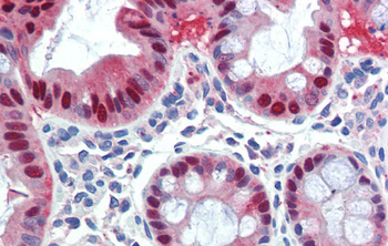 SCML1 Rabbit Polyclonal Antibody