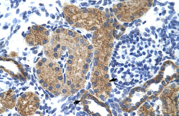 GTF3C5 Rabbit Polyclonal Antibody