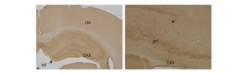 ESR2 Rabbit Polyclonal Antibody