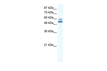 JMJD2D Rabbit Polyclonal Antibody