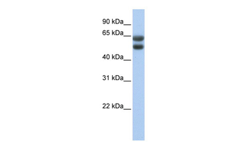 ZNF331 Rabbit Polyclonal Antibody