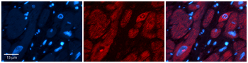 UPF1 Rabbit Polyclonal Antibody
