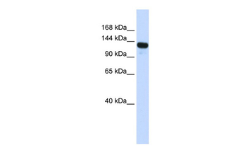 UPF1 Rabbit Polyclonal Antibody