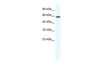 DDX5 Rabbit Polyclonal Antibody