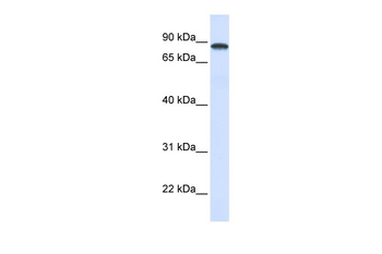 DDX1 Rabbit Polyclonal Antibody