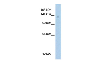 MOV10 Rabbit Polyclonal Antibody