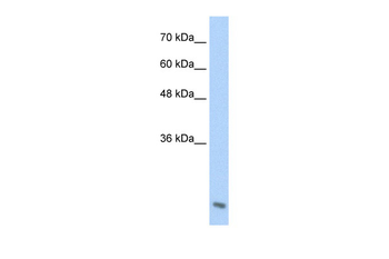 AES Rabbit Polyclonal Antibody