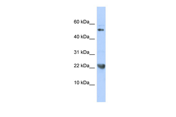 TNFSF12 Rabbit Polyclonal Antibody