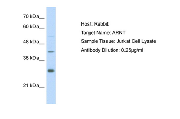 ARNT Rabbit Polyclonal Antibody