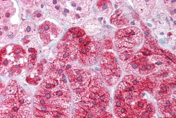ARC Rabbit Polyclonal Antibody