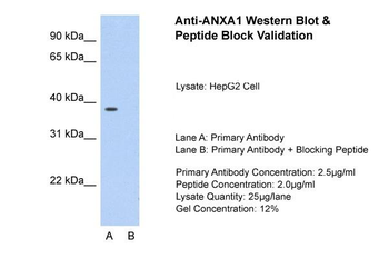 ANXA1 Rabbit Polyclonal Antibody