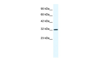 ANXA1 Rabbit Polyclonal Antibody