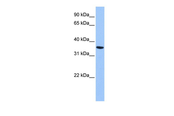 ANXA8L2 Rabbit Polyclonal Antibody