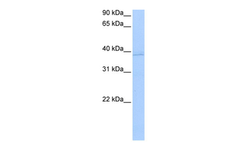 ANXA8L2 Rabbit Polyclonal Antibody