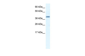 ANXA7 Rabbit Polyclonal Antibody
