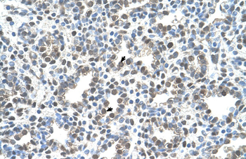 MCM3 Rabbit Polyclonal Antibody